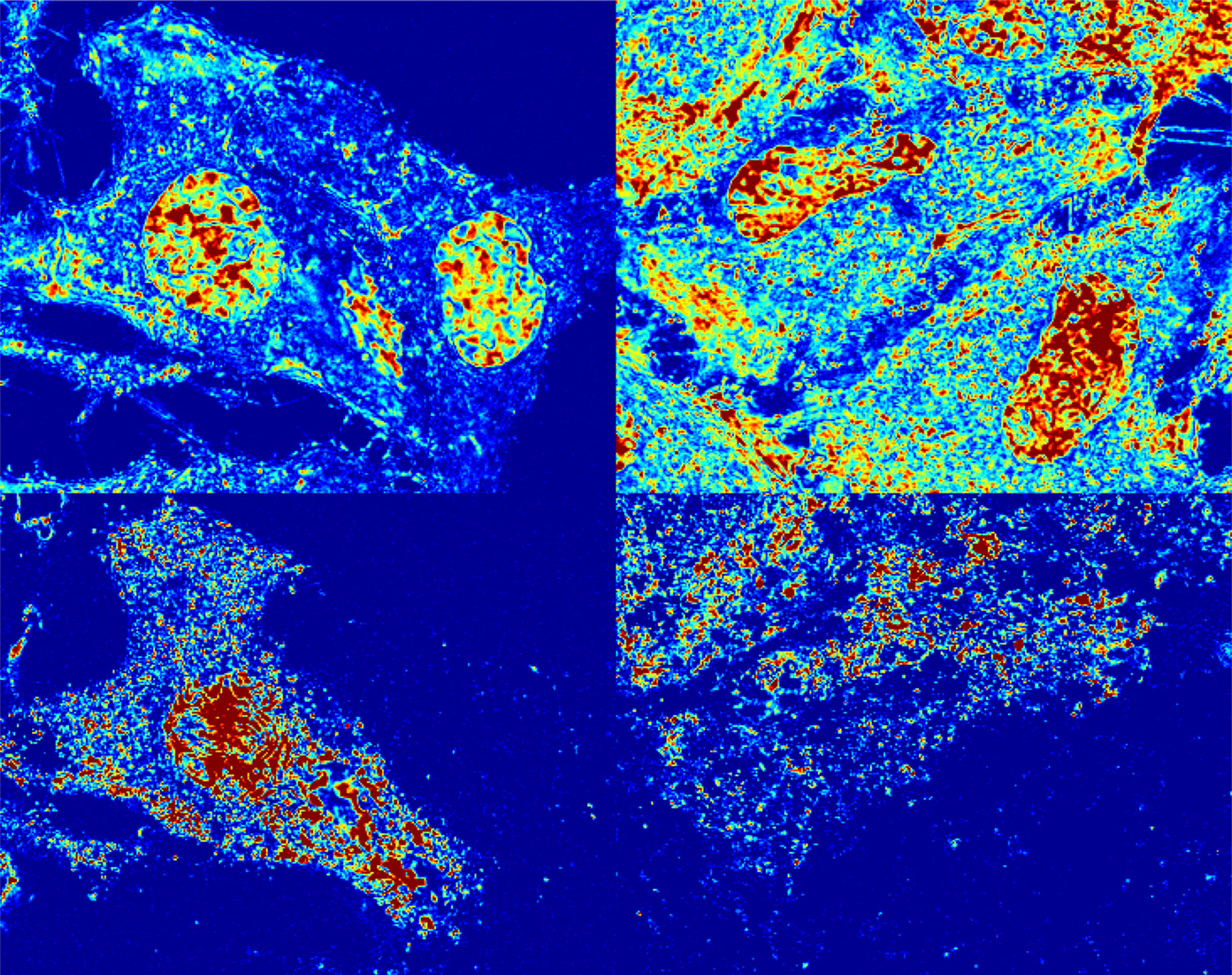 Four blocks of cancer cell representations on blue background