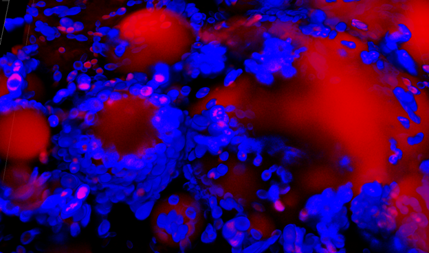 Images of Yarrowia lipolytica surrounding and growing on polyolefin oil droplets (large red circles). Cells were stained blue to show the chitin cell walls and red to show the lipid bodies inside the cells and the oil droplets outside the cells.