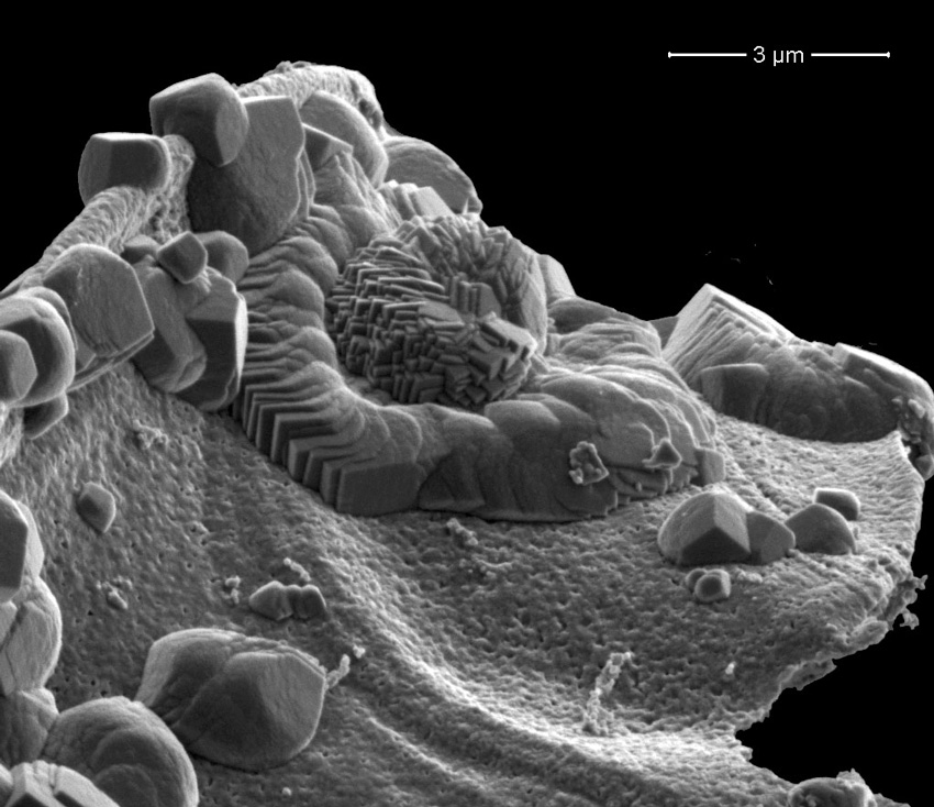 Detailed electron microscopy images.